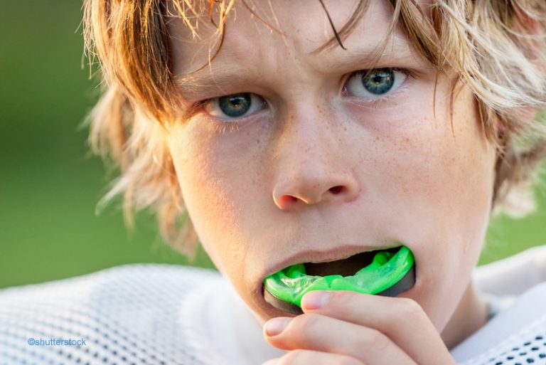 You Should Always wear a Mouthguard Dentist in Killeen, TX
